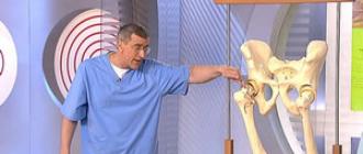 Choroby bedrového kĺbu, charakteristické symptómy a metódy liečby
