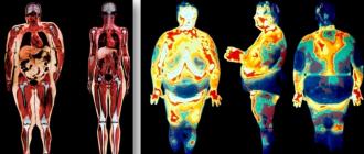 Comment perdre du poids rapidement sans régime et enlever l'estomac: un système qui fonctionne